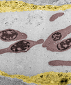 Pseudo-coloured electron micrograph depicting nanoparticles circulating in the bloodstream along with red blood cells (red) and those sequestered in endothelial cells lining the blood vessel (yellow). (Figure: Yuya Hayashi).